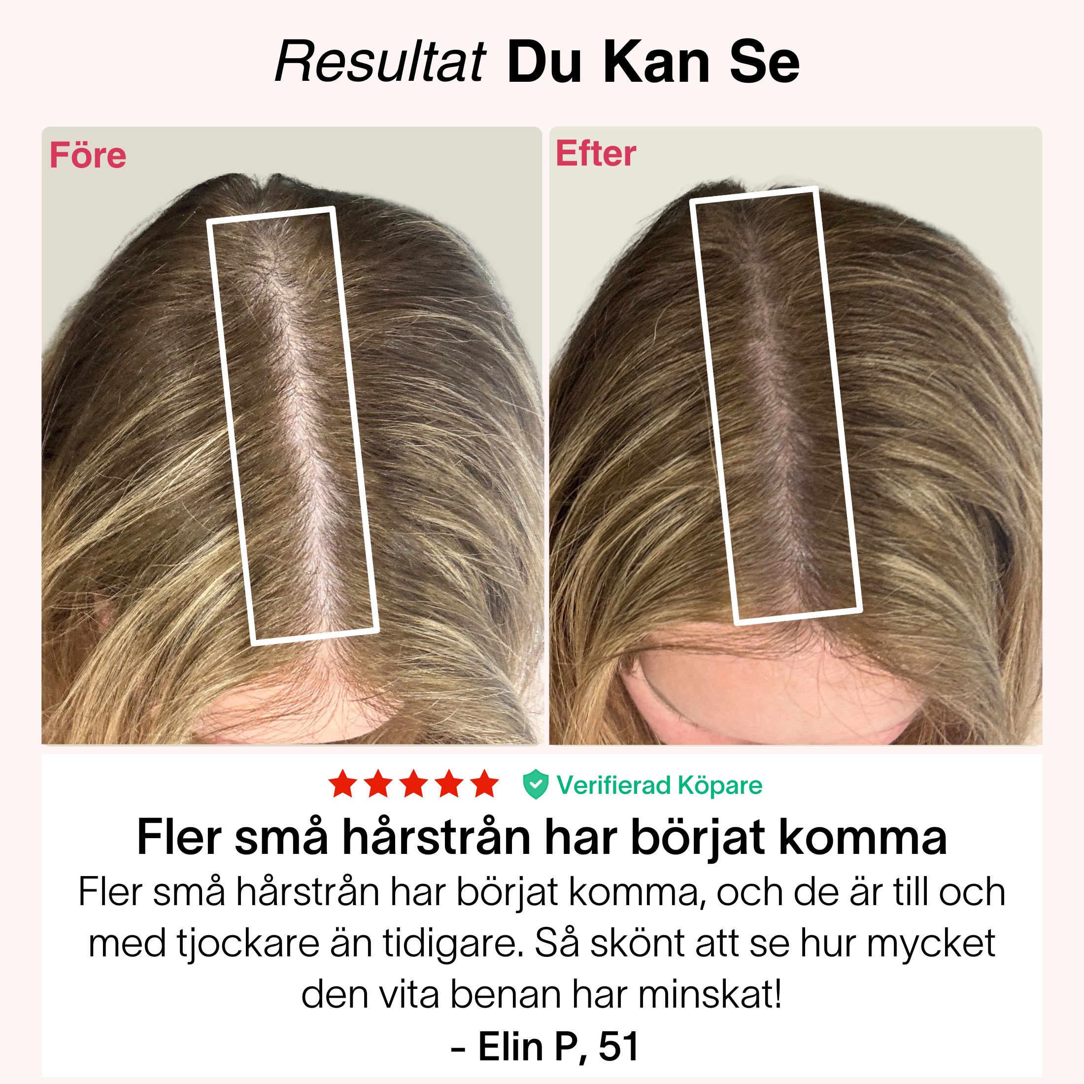 Rödljus-Kepsen® – bild 7