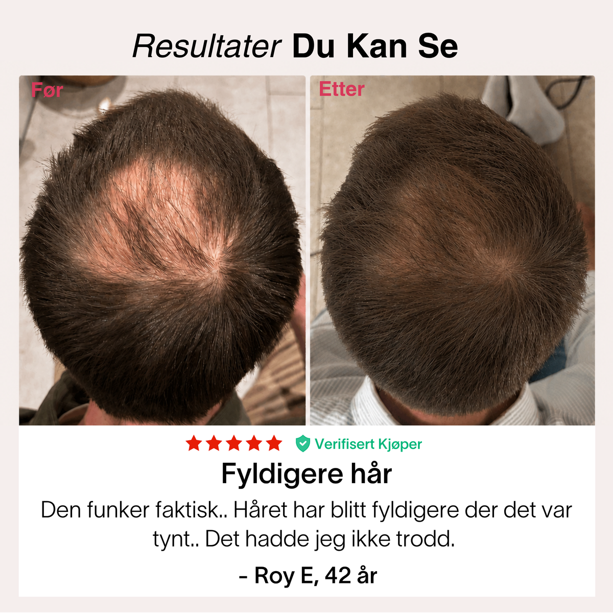 Rødlys-Capsen® – bilde 4