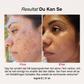 SoftSkin InfraLight | Ansikte, Hals & Bröst – bild 5