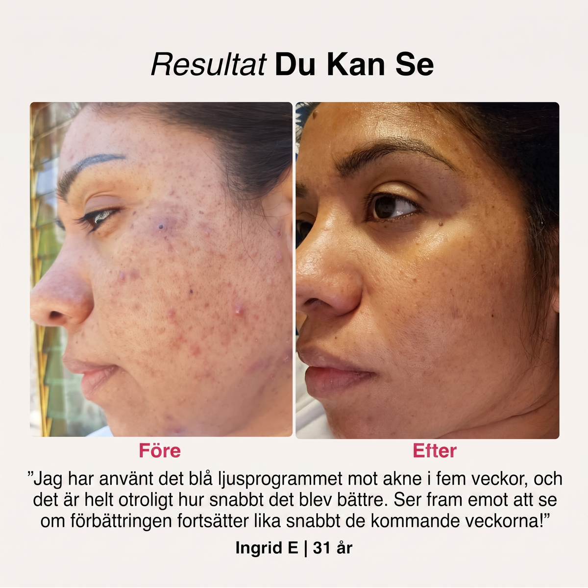 SoftSkin InfraLight | Ansikte, Hals & Bröst – bild 5