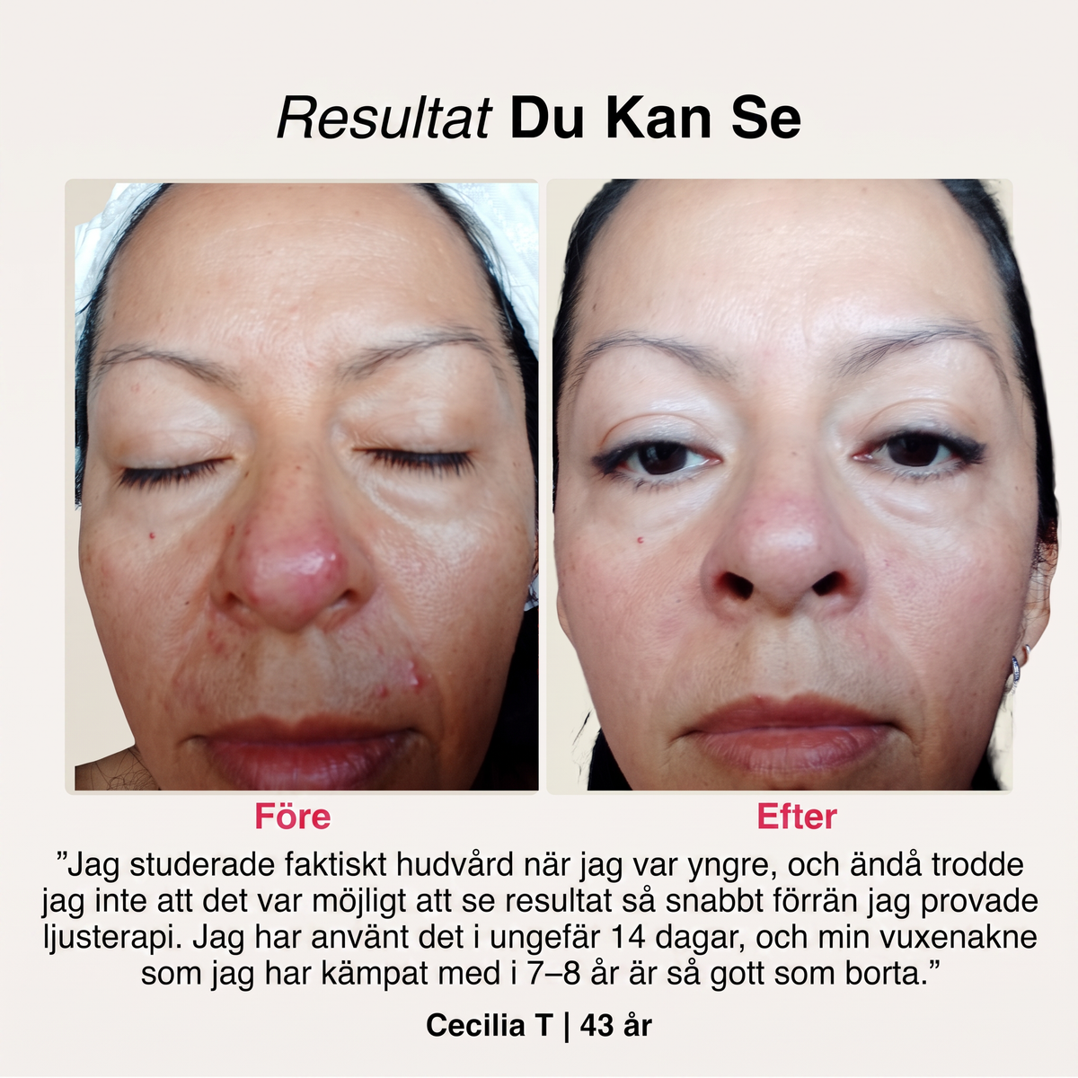 SoftSkin InfraLight | Ansikte, Hals & Bröst – bild 4